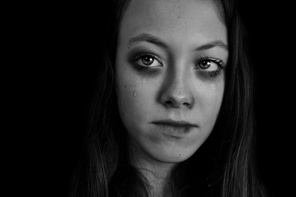 Portrait of girl with bruised face